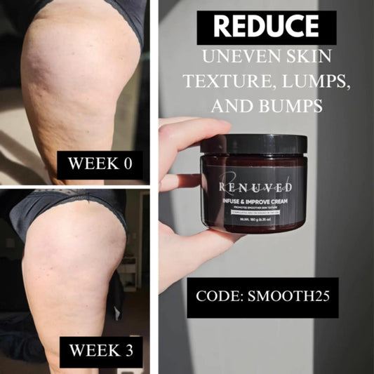 Spring Prep: Get Smooth, Summer-Ready Skin with Renuved
