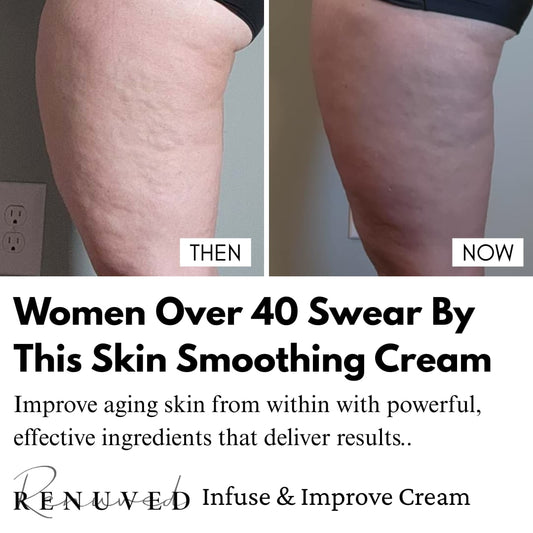 What Causes Dimpled Skin on Legs and How to Address It with Renuved Infuse & Improve Cream