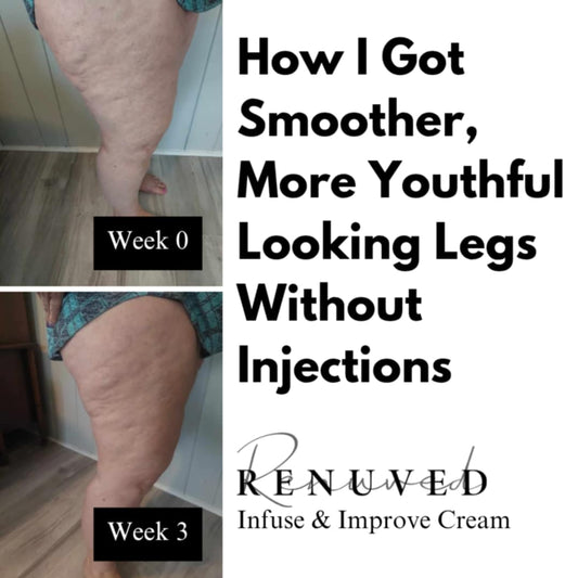 Are There Any Creams That Help with Cellulite on Thighs