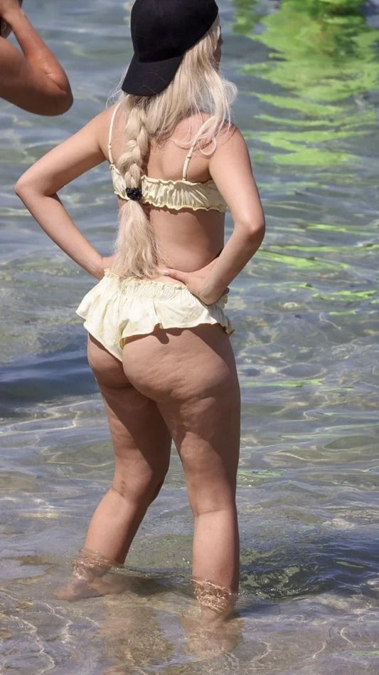 Is Any Man Turned Off by Cellulite? Let’s Dig Into the Real Talk