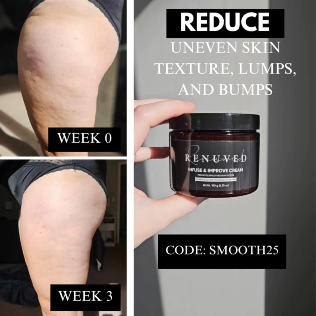 Spring Prep: Get Smooth, Summer-Ready Skin with Renuved