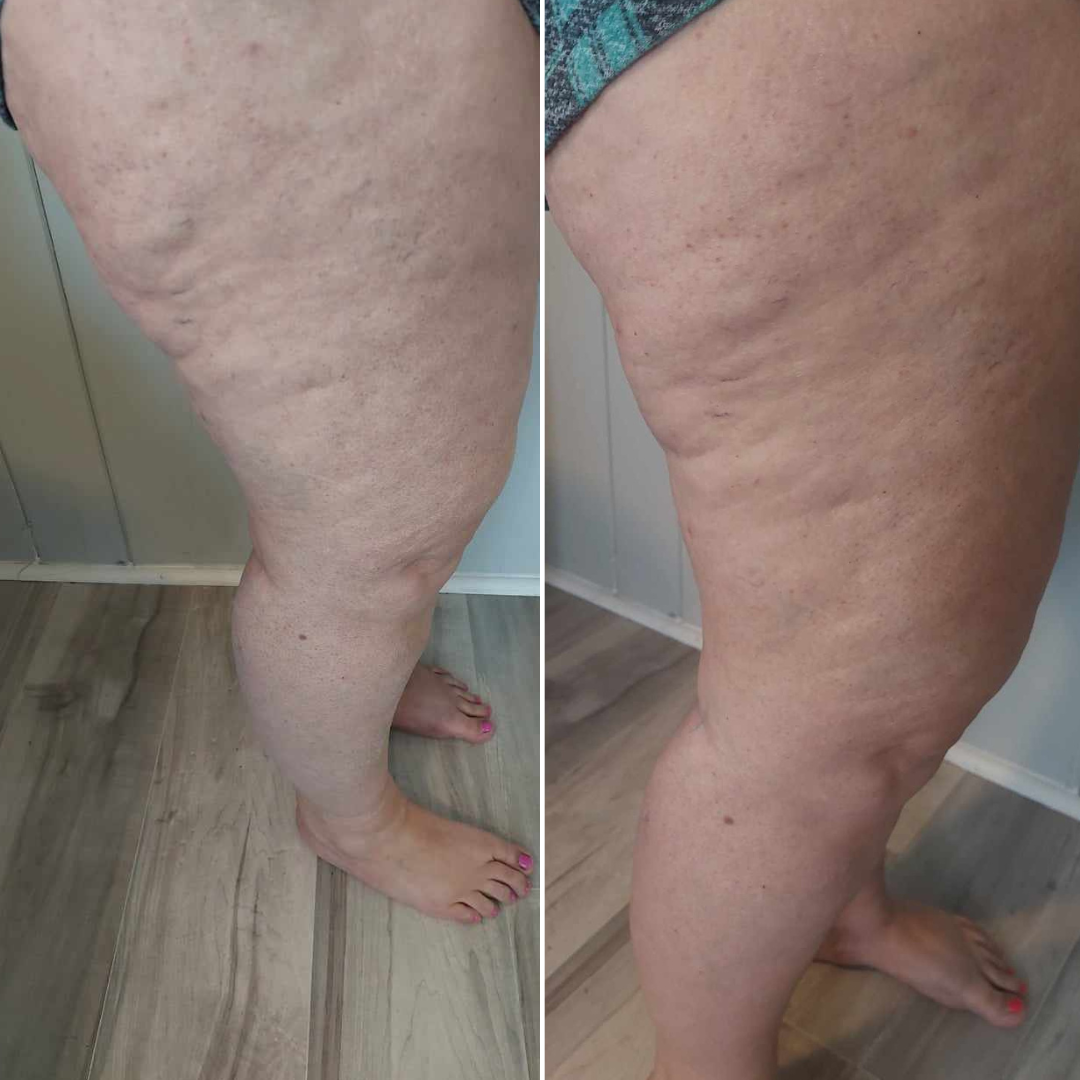 Infuse & Improve Cream