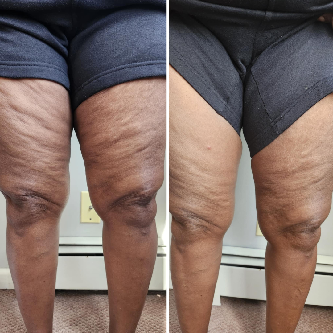 Infuse & Improve Cream