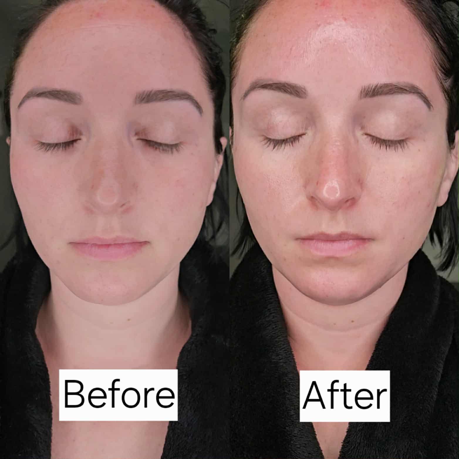 RejuvaTea Exfoliator