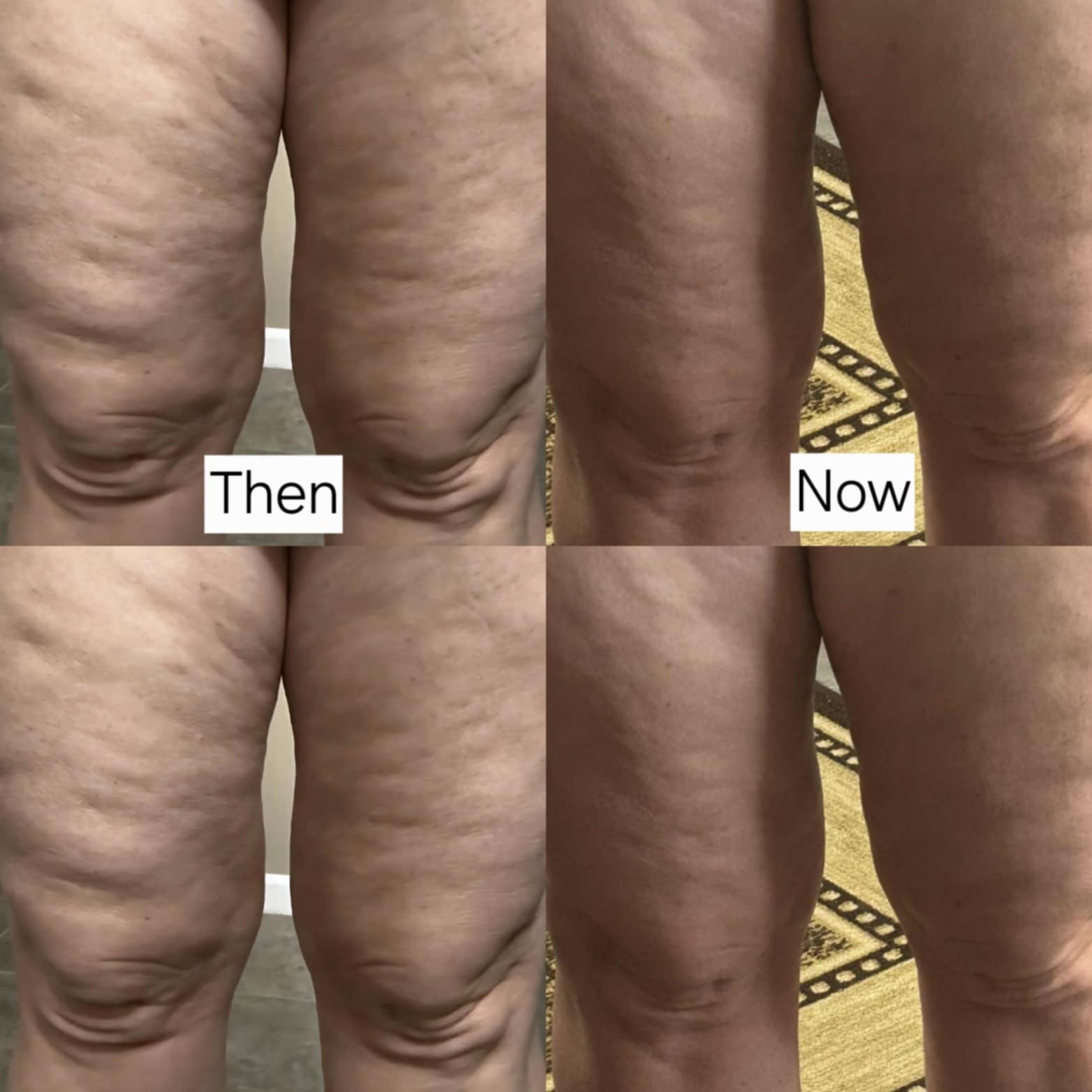 Infuse & Improve Cream